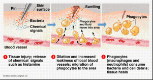 inflammation